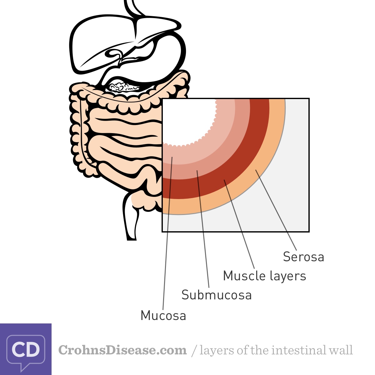 Layers of the digestive tract. The innermost layer is the mucosa, followed by the submucosa, muscle layers, and serosa.