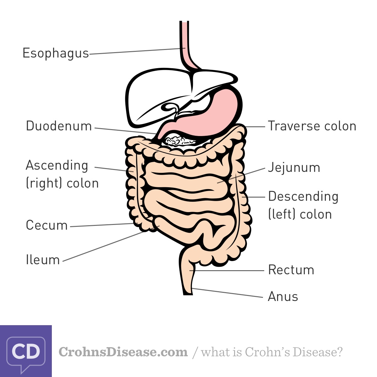 Parts of the digestive tract from the esophogus to the anus that can be affected by Crohn's disease.