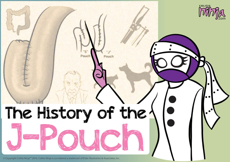 J-pouch history