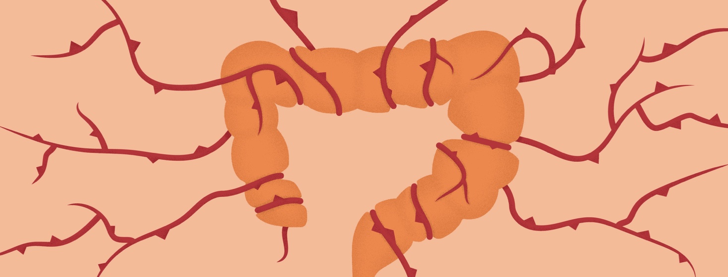 large intestine with thorny vines wrapped around it and expanding out