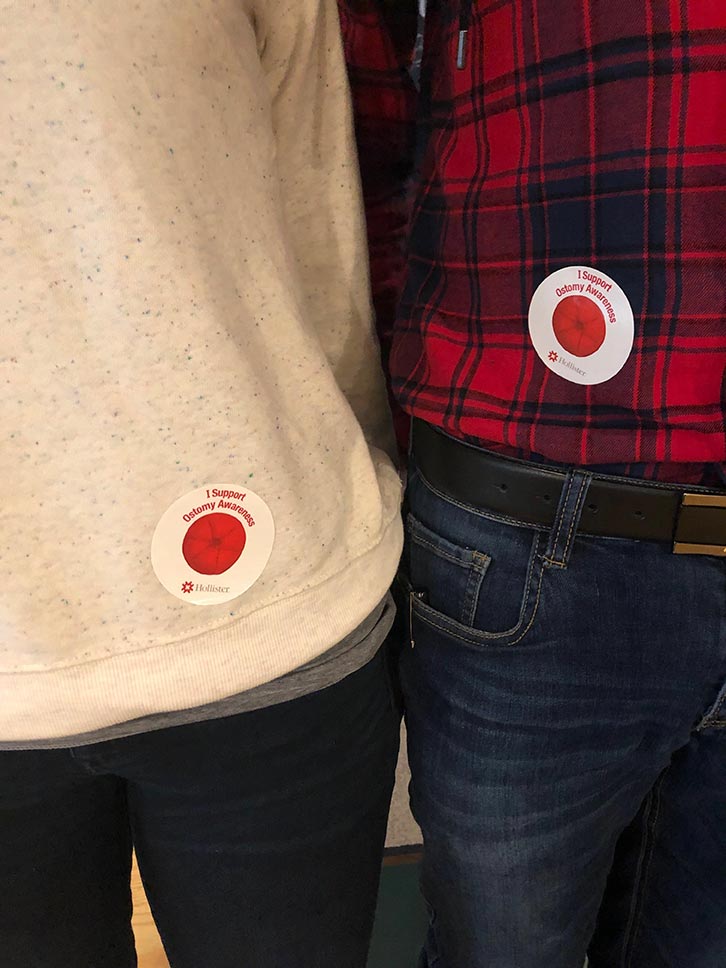 ostomy stickers on two people