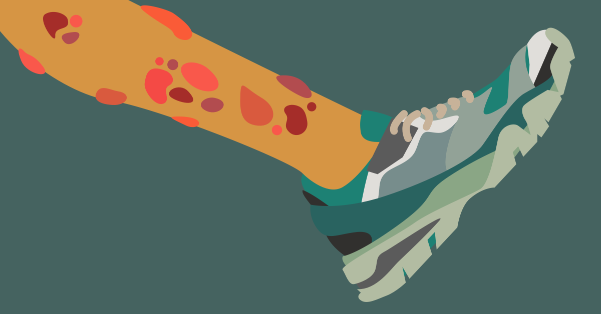 Why Does Crohn's or UC Cause Erythema Nodosum? | IBD