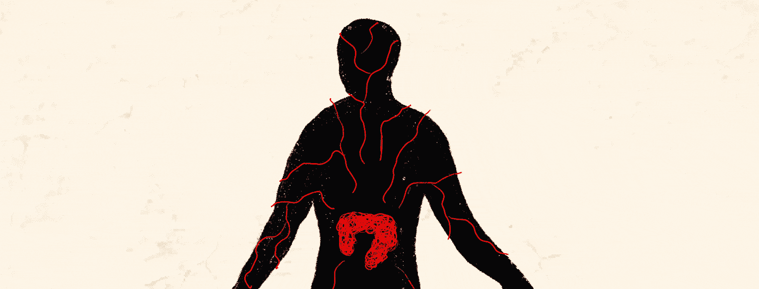 pain lines radiate off a colon to the rest of the body