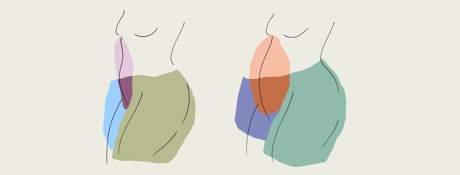 Two abdominal illustrations, the left one is an inflamed stomach and the right one is a bulged and inflamed stomach colored in red.
