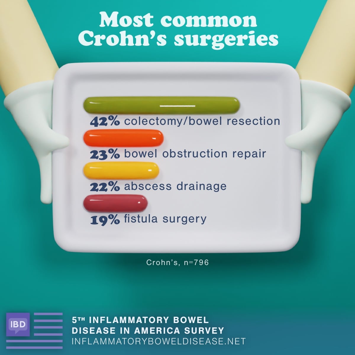 Most common Crohn's surgeries. 42% had a colectomy/bowel resection, 23% had bowel obstruction repair, 22% had abscess drainage, and 19% had a fistula surgery.