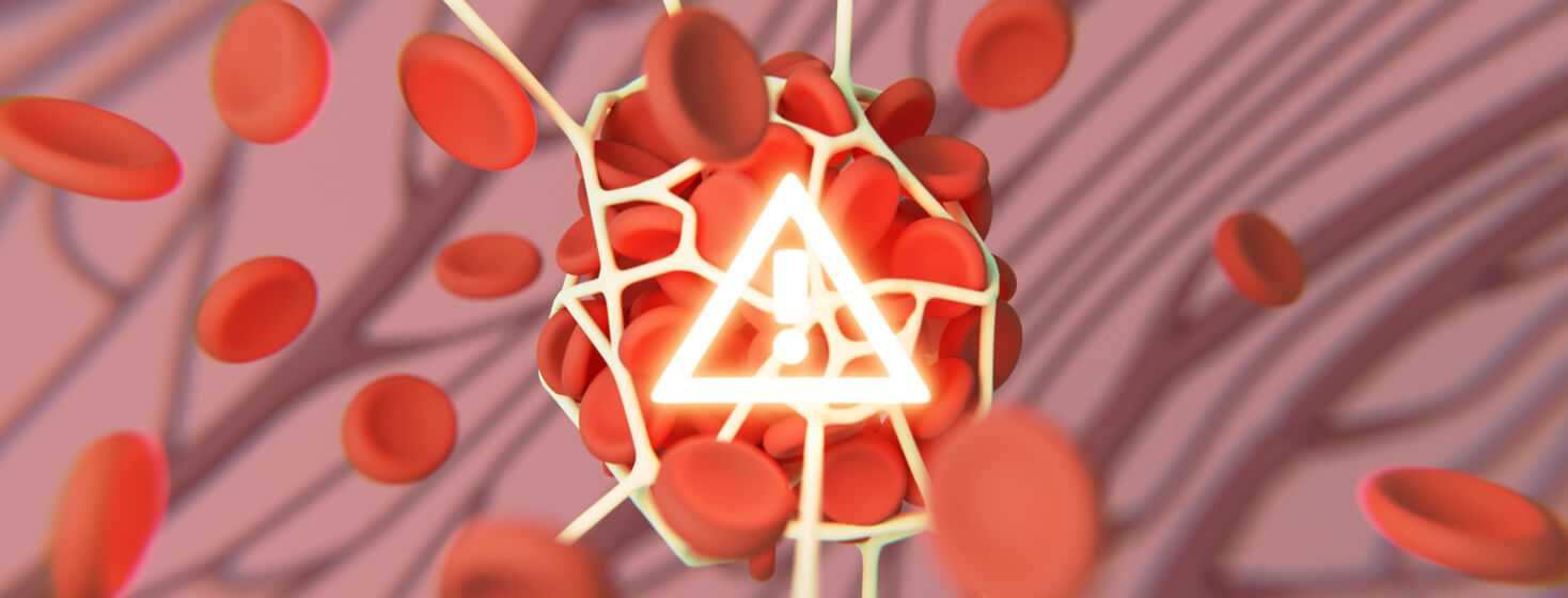 Blood clots form together with an emergency symbol in the middle