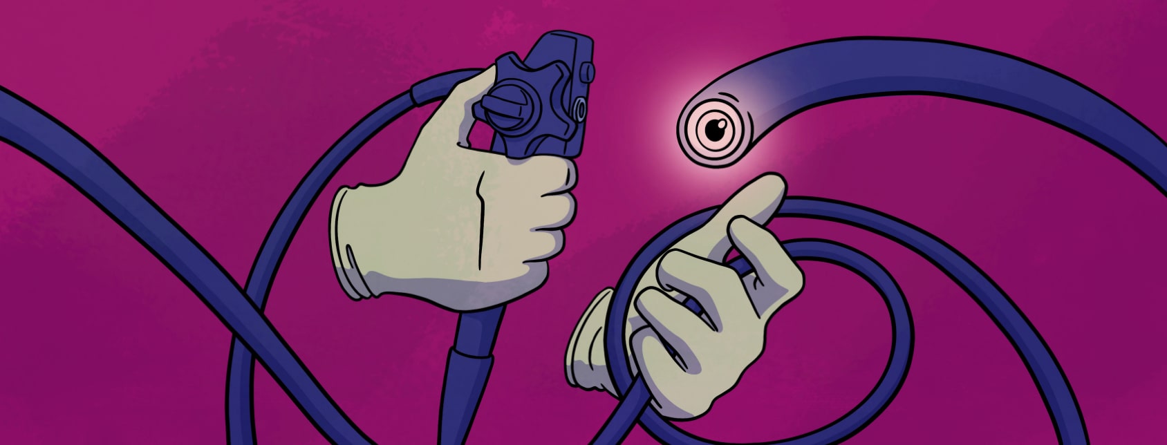 Gloved hands wrangling a serpent-like colonoscope with a glowing eye.