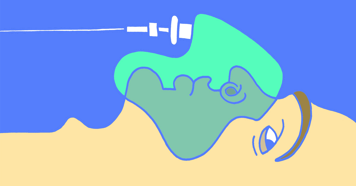 Can Anesthesia Cause Stomach Issues With IBD?