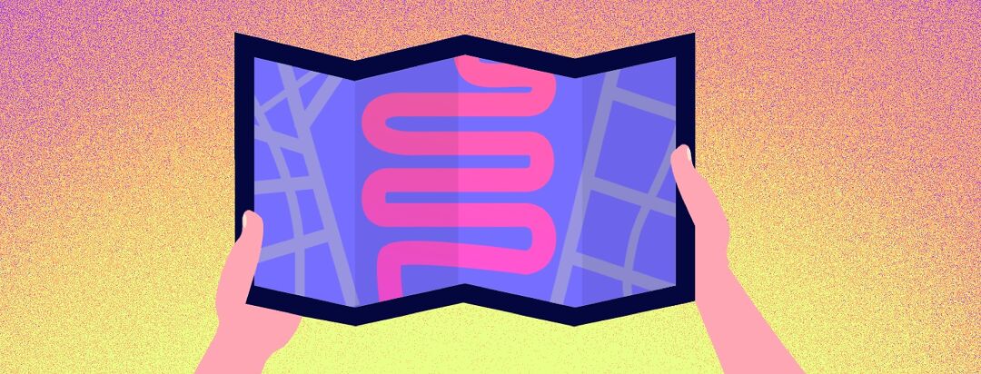 Ulcerative Colitis: From Flare to Function image